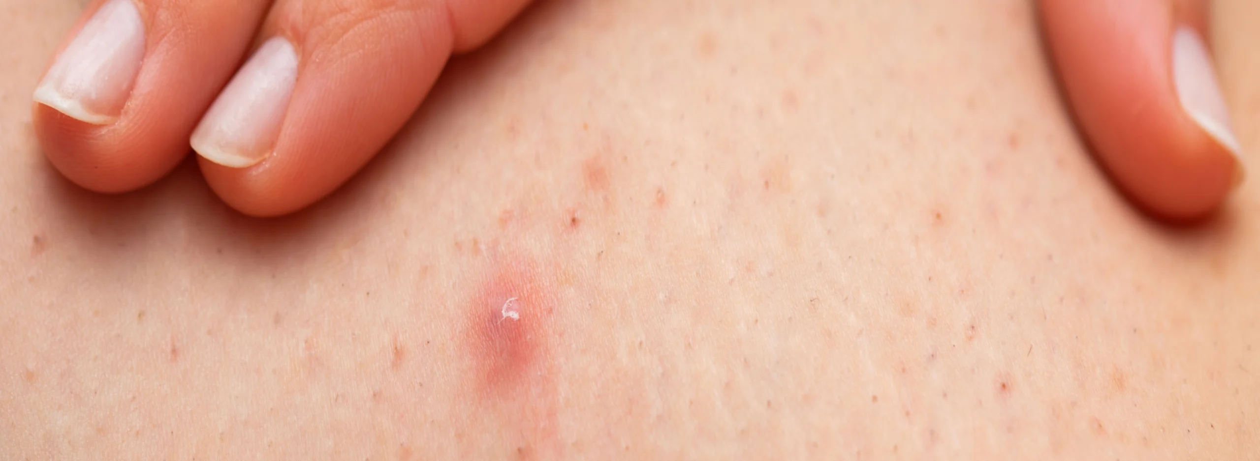 3 stages of hair growth - buyitalwax.com